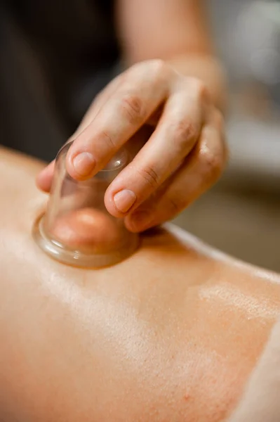 A woman's hand makes a vacuum massage with a medical jar on the leg close-up. Vacuum massage jar.