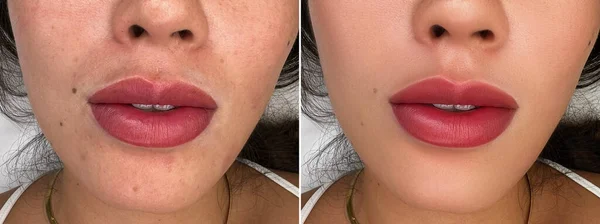 Labios Después Del Maquillaje Permanente Cerca Los Labios Una Mujer —  Fotos de Stock