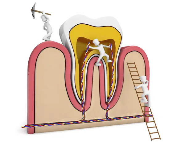 Germes dente de perfuração — Fotografia de Stock