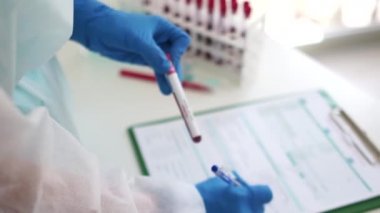 Bir laboratuvar asistanının elinde kan örneğiyle test tüpü tutarken çekilmiş fotoğrafı. Kan sayımı pozitif çıktı. Yeni virüs türü, omicron veya delta