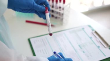 Yan görüş doktorları laboratuarda viral hastalık için COVID-19 2019-nCoV test tüpü tutuyorlar. Viral Coronavirus 'un test sonuçlarının laboratuvar kaydı.