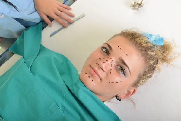 Femme avant la chirurgie plastique — Photo