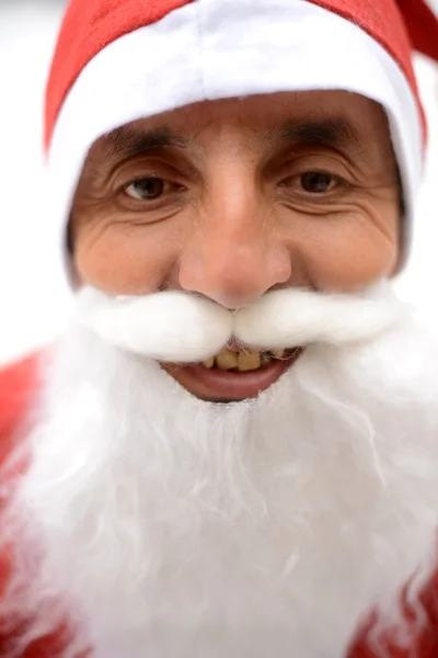 Santa com síndrome de down — Fotografia de Stock