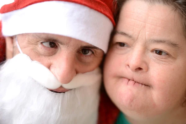 Santa with down syndrome — Stock Photo, Image