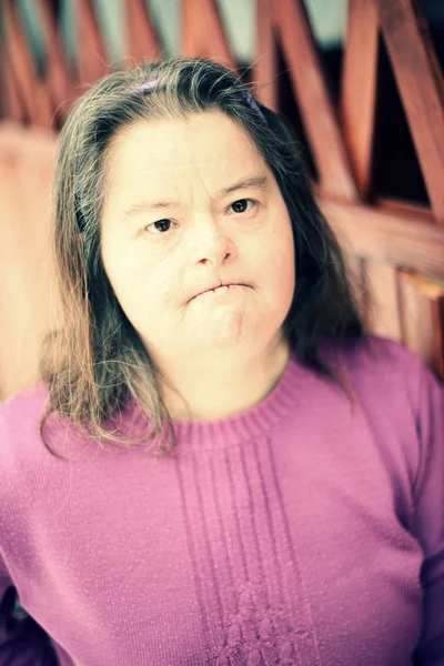 Woman with down syndrome — Stock Photo, Image