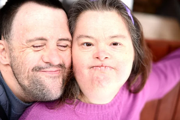 Love couple with down syndrome — Stock Photo, Image