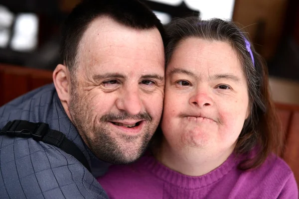 Älska par med Downs syndrom — Stockfoto