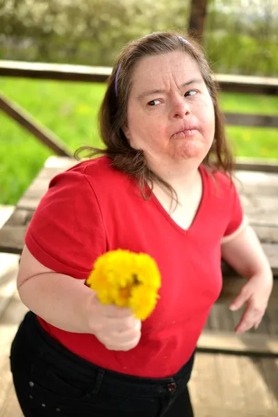 Mulher com síndrome de Down — Fotografia de Stock