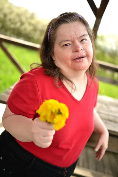 Frau mit Down-Syndrom — Stockfoto