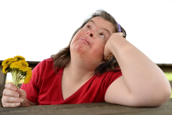 Down syndrome woman — Stock Photo, Image