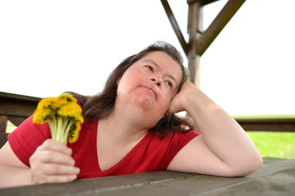 Down syndrome woman — Stock Photo, Image