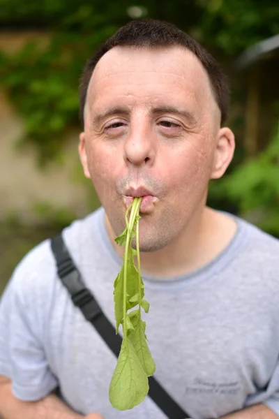 Dawn syndrome man with radish — Stock Photo, Image