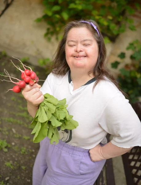 Dawn syndroom vrouw met radijs — Stockfoto