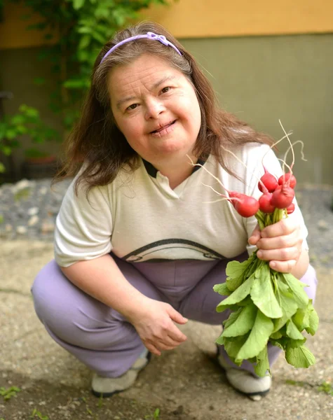 Mulher síndrome de Dawn com rabanete — Fotografia de Stock