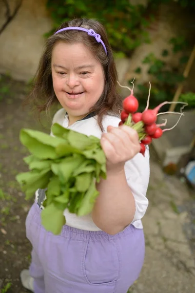 Dawn syndroom vrouw met radijs — Stockfoto