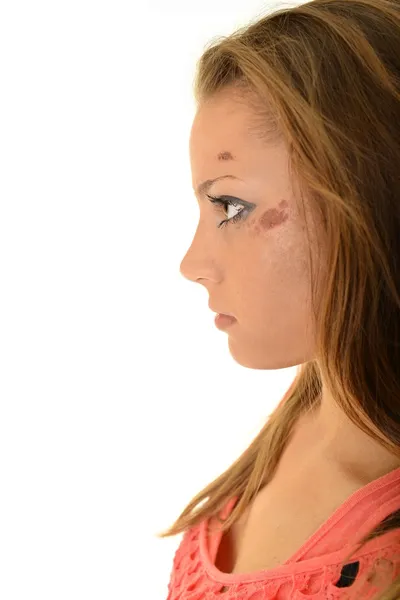 Schöne Frau Opfer häuslicher Gewalt — Stockfoto