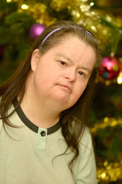 Woman with down syndrome — Stock Photo, Image