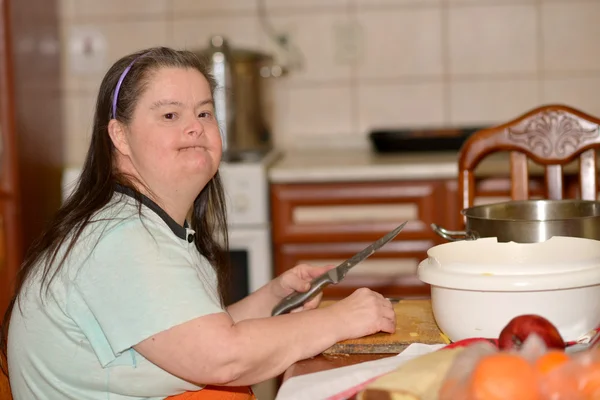 Woman with down syndrome — Stock Photo, Image