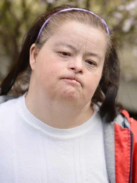 Woman with down syndrome — Stock Photo, Image