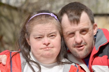 Down sendromlu Çift