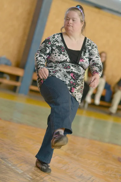 Woman with down syndrome — Stock Photo, Image