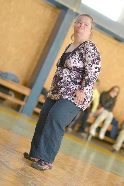 Mujer con síndrome de Down — Foto de Stock