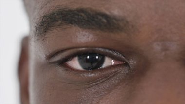 Afrikalıların Göz Kırpan Gözü