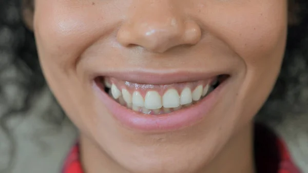 Detailní záběr na usmívající se ústa africké ženy — Stock fotografie