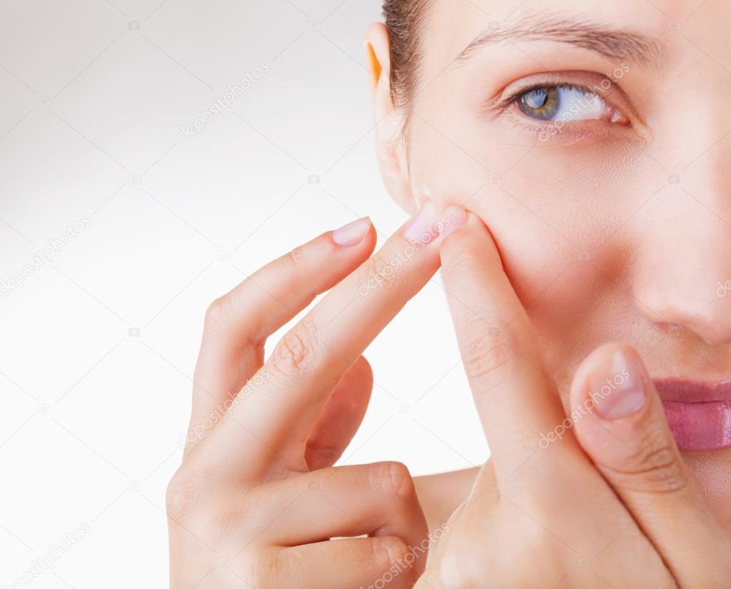 Acne on female skin.