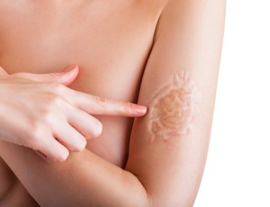 Woman showing scar clipart