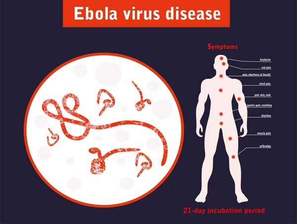 Vektorová Ilustrace Onemocnění Virem Ebola — Stockový vektor