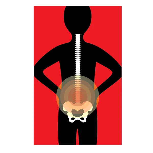 Rückenschmerzen — Stockvektor