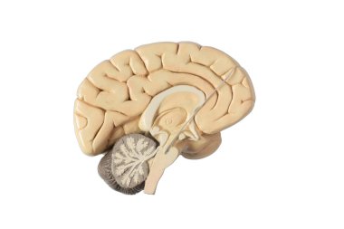 Parkinson hastalığının tedavisi için subtalamik çekirdekte derin beyin uyarısı. Beyaz arka planda izole edilmiş beyin modeli..