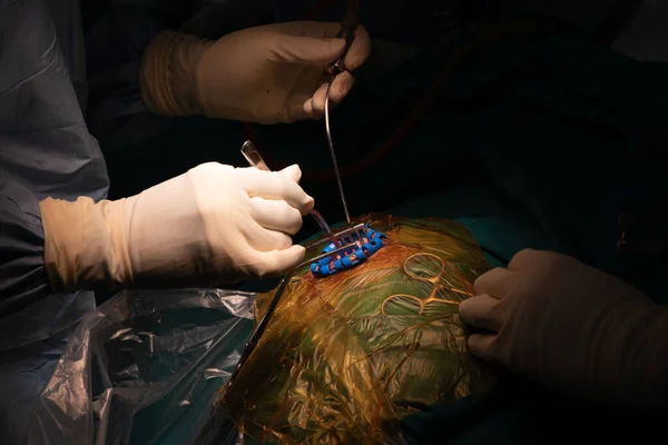 Neurosurgeon performing brain surgery in operating room