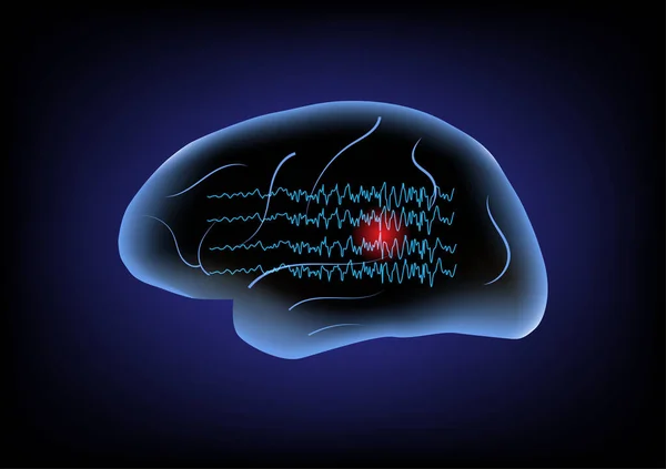 Illustration Des Ondes Cérébrales Cérébrales Humaines Concept Saisie Focale — Image vectorielle