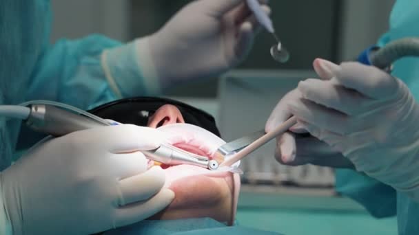Las Manos Dentista Asistente Con Instrumentos Quirúrgicos Taladro Dental Tratan — Vídeos de Stock