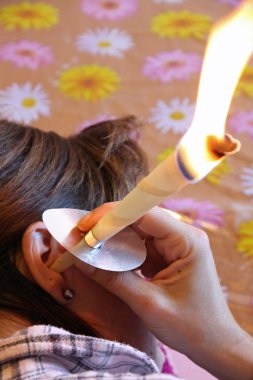 young woman uses cones of wax to clean ear wax clipart