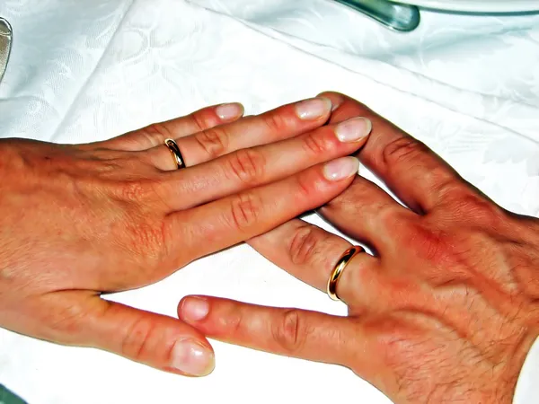 Two hands with rings — Stock Photo, Image