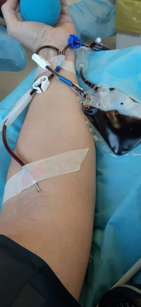 Brazo Generoso Donante Sangre Hospital Durante Transfusión Bolsa Sangre — Foto de Stock