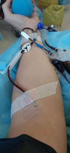 Bras Donneur Sang Pendant Transfusion Hôpital Une Boule Bleue Main — Photo