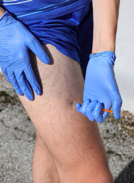 Sporty Boy Sports Shorts While Injecting Dose Insulin Because Has — ストック写真