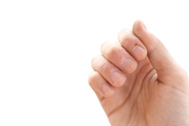 Beyaz bir arka plan ısırıldı parmak yakın çekim. Korkunç kötü bir elin parmaklarını ısırıldı. Stres. Sinirlilik. Alışkanlık. Depresyon. Kadar kan. Sakat. İzole.