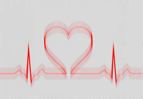 Hjärtat elektrokardiogram — Stockfoto