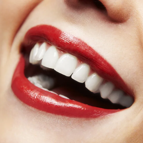 Жінка посміхається. Відбілювання зубів. Стоматологічна допомога . Ліцензійні Стокові Зображення