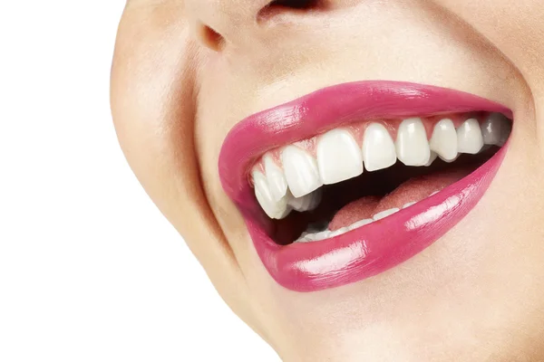 Mulher sorrindo com grandes dentes no fundo branco — Fotografia de Stock