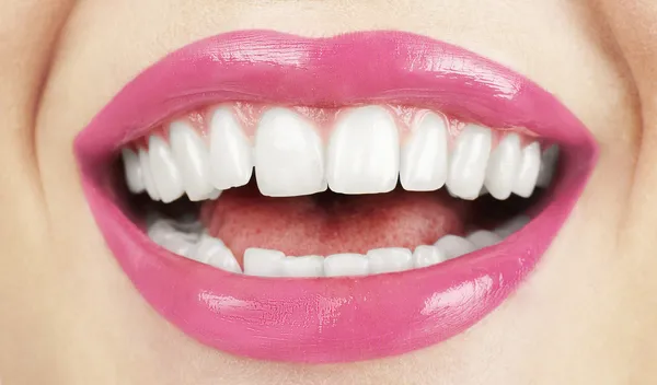Doskonały uśmiech. zdrowy ząb. — Zdjęcie stockowe