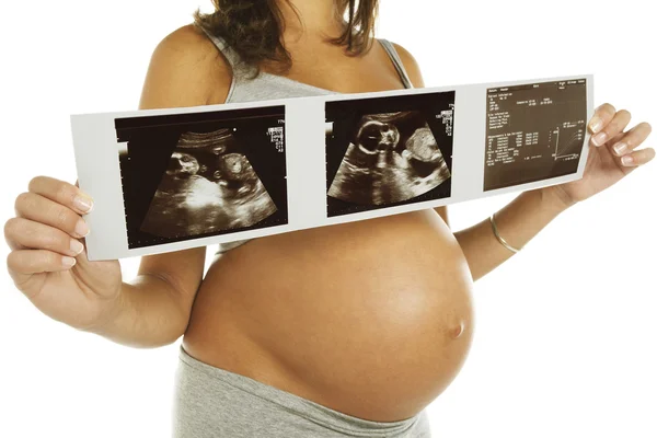 Mujer embarazada sosteniendo imágenes de ultrasonido —  Fotos de Stock