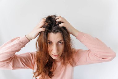 Mutsuz genç bir kadın kepekten kaynaklanan ellerle kafasını kaşıyor.