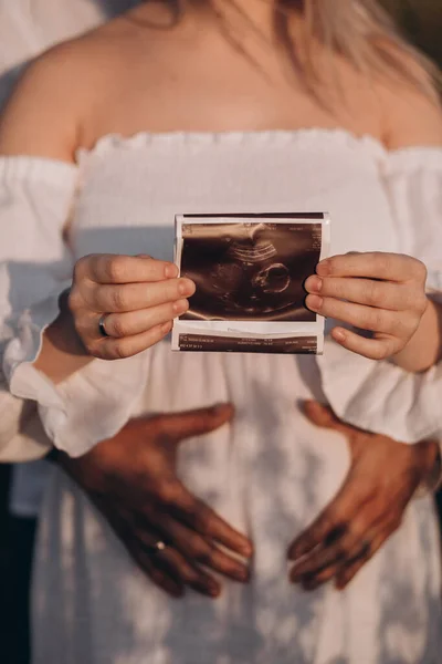 Güzel Elbiseli Hamile Bir Kadın Kocası Yaz Tarlasında Yürüyor — Stok fotoğraf