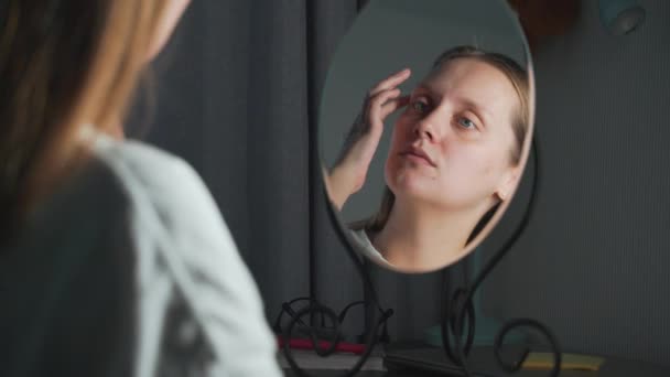 La joven se mira en el espejo, examina la piel de su cara y se molesta. Hay enrojecimiento y granos en la cara. La chica está molesta. Salud, cosmetología — Vídeos de Stock